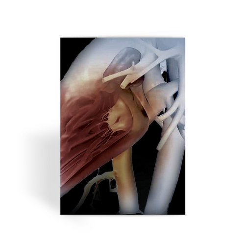 Black Heart Greeting Card