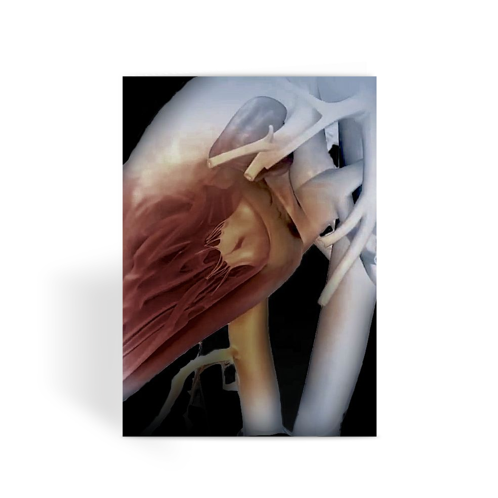 Black Heart Greeting Card